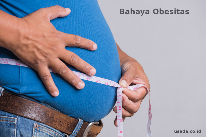 Apa Saja Bahaya Obesitas yang Harus Dihindari?